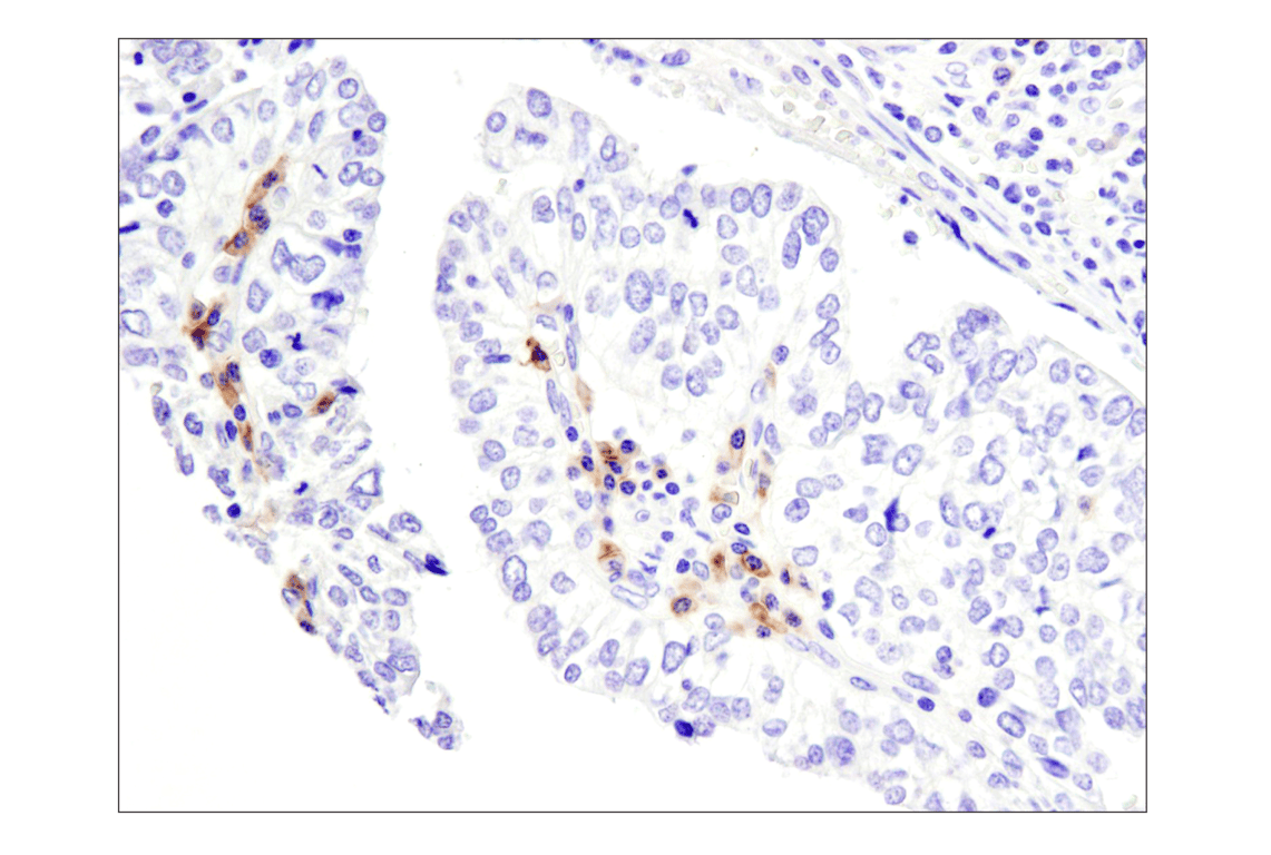 Immunohistochemistry Image 9: TNFRSF17/BCMA (E6D7B) Rabbit Monoclonal Antibody