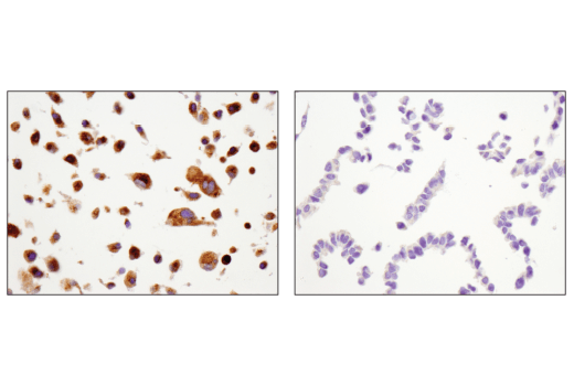 Immunohistochemistry Image 2: MMP-2 (D4M2N) Rabbit Monoclonal Antibody (BSA and Azide Free)