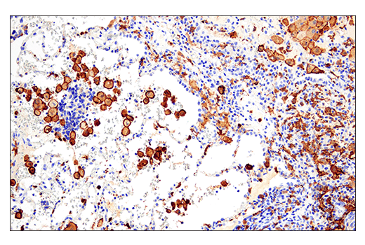 Immunohistochemistry Image 1: Iba1/AIF-1 (E4O4W) Rabbit Monoclonal Antibody (BSA and Azide Free)