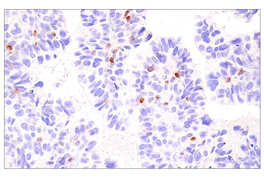 Immunohistochemistry Image 4: CCL5/RANTES (E9S2K) Rabbit Monoclonal Antibody (BSA and Azide Free)