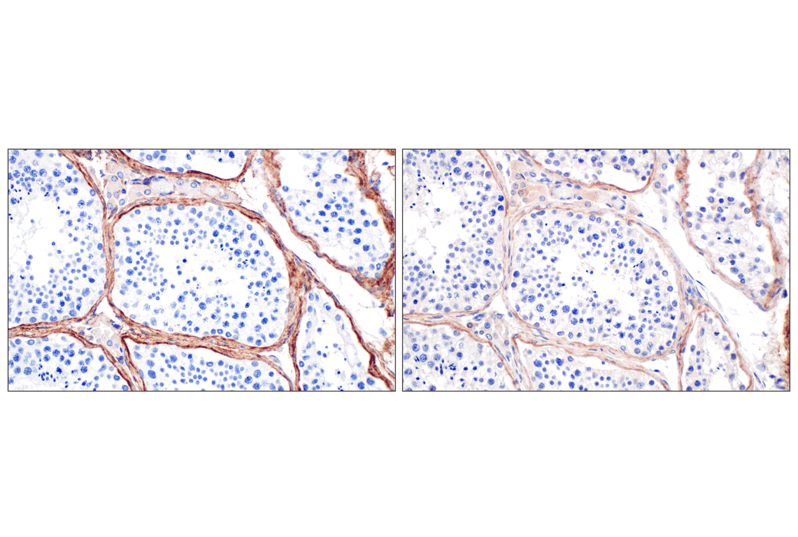 Immunohistochemistry Image 4: COL6A1 (E9U3B) Rabbit Monoclonal Antibody (BSA and Azide Free)