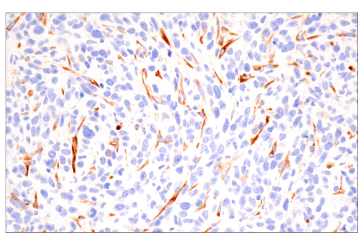 Immunohistochemistry Image 7: CTHRC1 (E8M9S) Rabbit Monoclonal Antibody