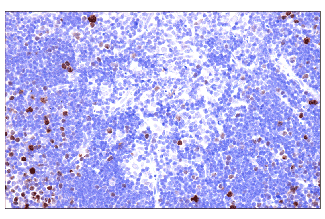 Immunohistochemistry Image 13: Phospho-NPM1 (Thr199) (E4C7S) Rabbit Monoclonal Antibody (BSA and Azide Free)