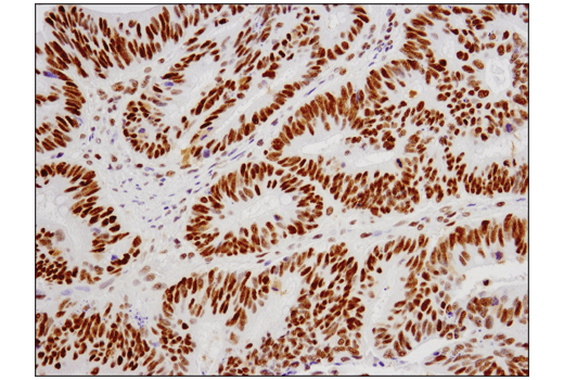 Immunohistochemistry Image 1: ESET (D4M8R) XP<sup>®</sup> Rabbit mAb