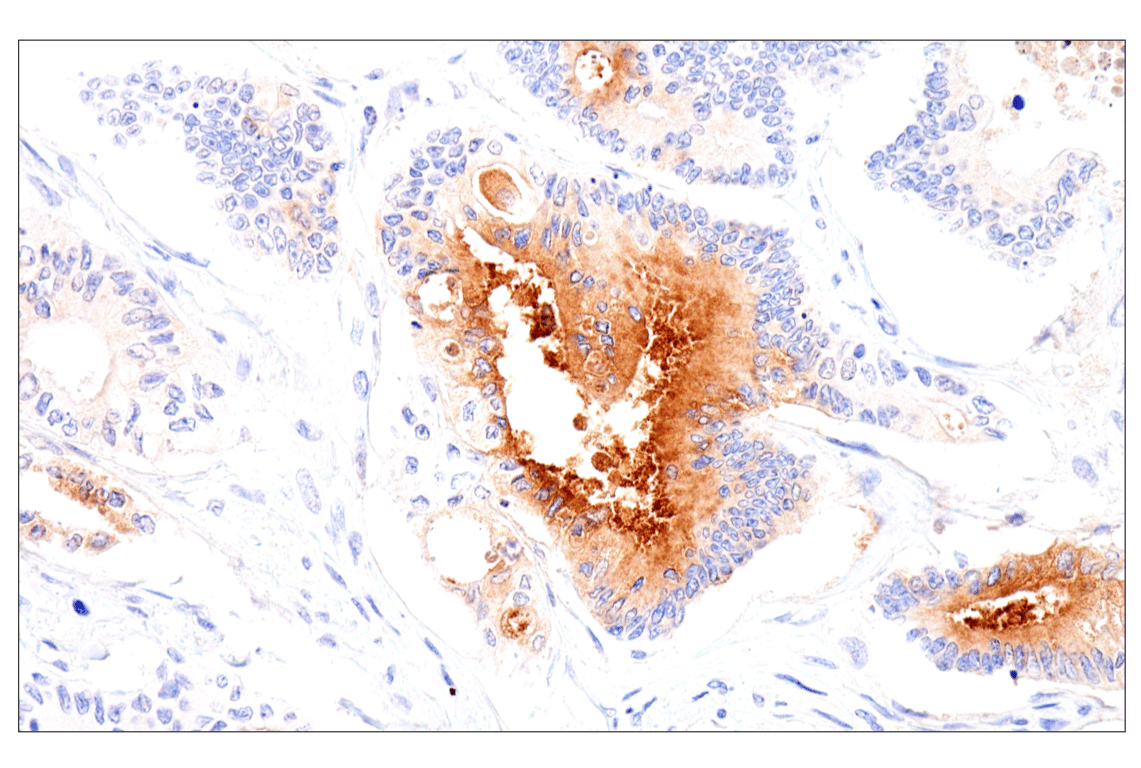 Immunohistochemistry Image 2: Folate Receptor Alpha/FOLR1 (BN3.2) Mouse Monoclonal Antibody
