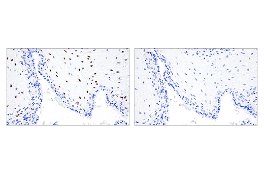 Immunohistochemistry Image 6: PML (E6S9L) Rabbit Monoclonal Antibody