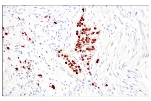 Immunohistochemistry Image 2: LCN2 (D4M8L) Rabbit Monoclonal Antibody