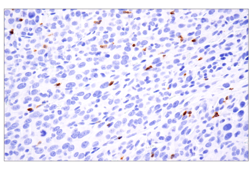 Immunohistochemistry Image 3: Ly-6G (E6Z1T) Rabbit Monoclonal Antibody (BSA and Azide Free)