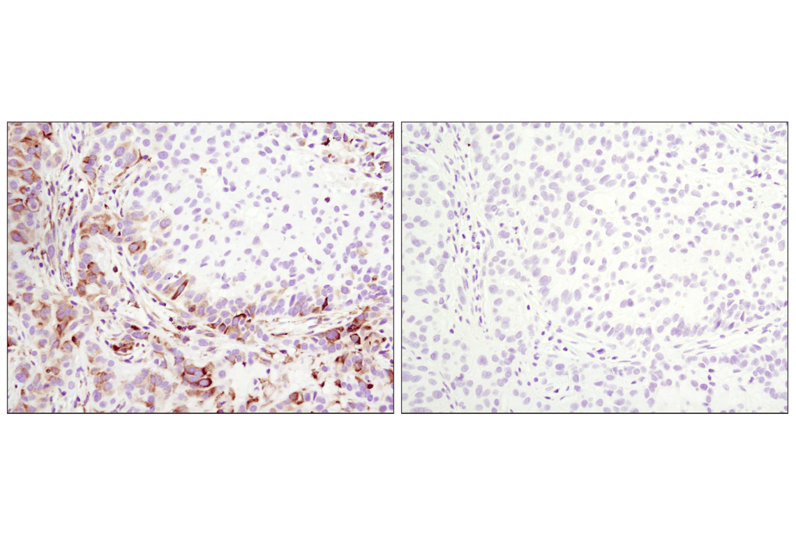 Immunohistochemistry Image 5: Phospho-S6 Ribosomal Protein (Ser235/236) (D57.2.2E) Rabbit Monoclonal Antibody