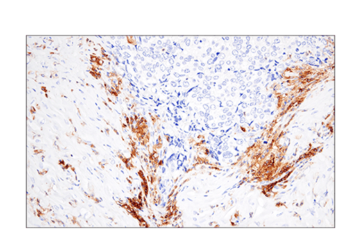 Immunohistochemistry Image 6: CRACC/SLAMF7/CD319 (E5C4M) Rabbit Monoclonal Antibody