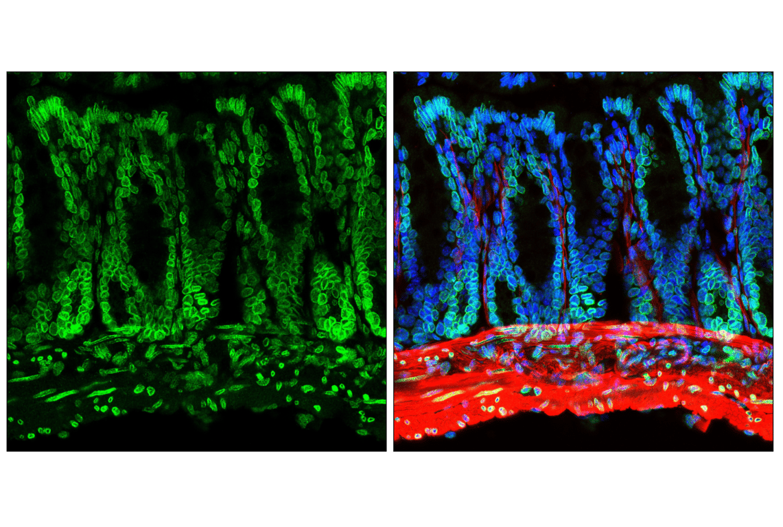 Immunofluorescence Image 1: NUP153 (E3N3Y) Rabbit Monoclonal Antibody