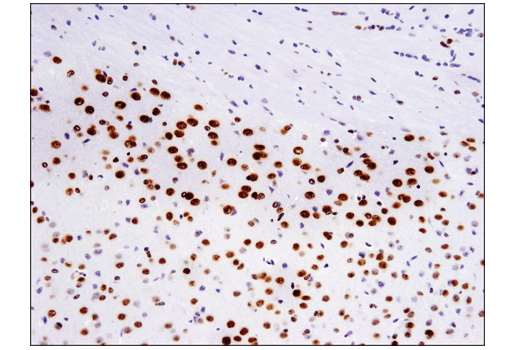 Immunohistochemistry Image 4: TDP43 (D9R3L) Rabbit Monoclonal Antibody (BSA and Azide Free)