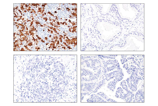 Immunohistochemistry Image 1: LIN28A (D84C11) Rabbit Monoclonal Antibody