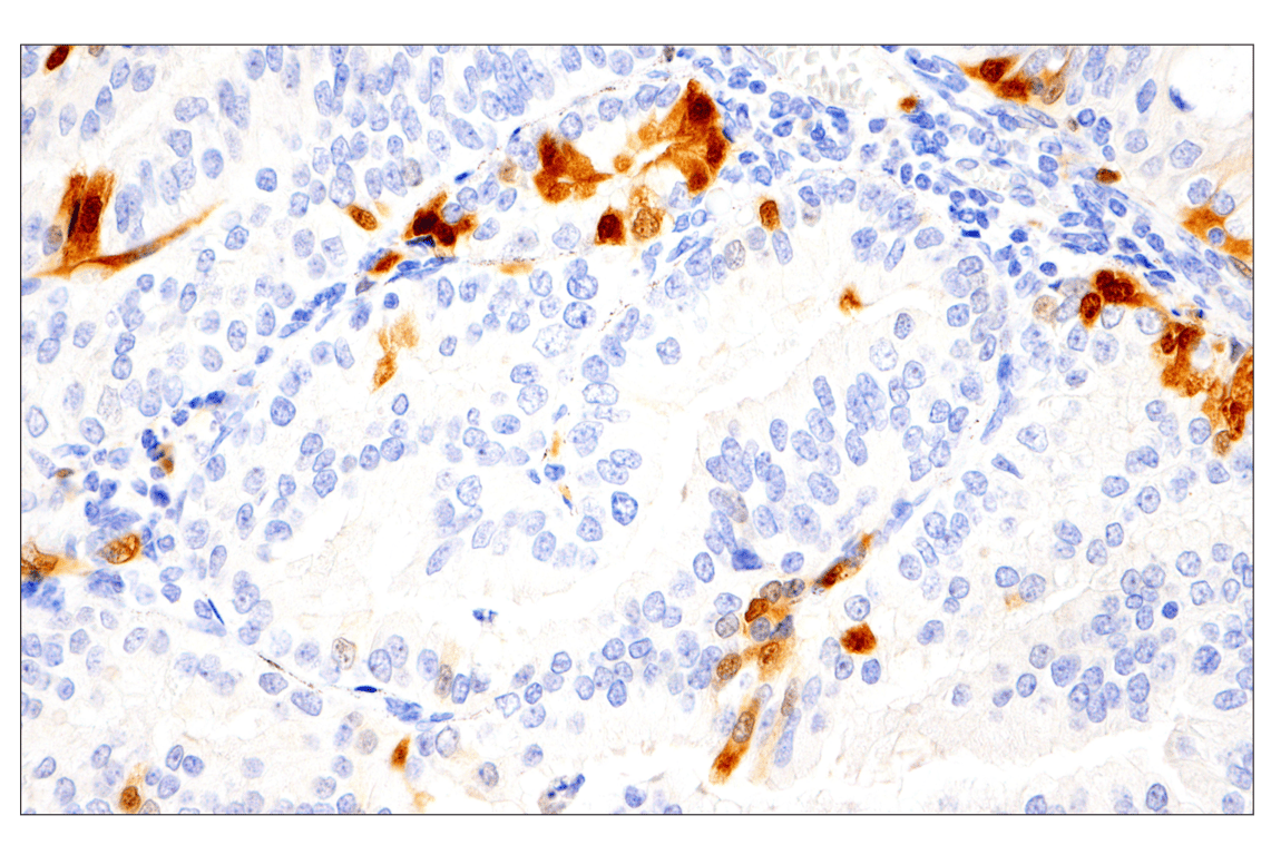 Immunohistochemistry Image 6: Phospho-p44/42 MAPK (Erk1/2) (Thr202/Tyr204) (D13.14.4E) Rabbit Monoclonal Antibody (BSA and Azide Free)