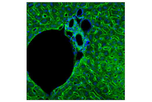 Immunofluorescence Image 4: PICALM (E3J9R) Rabbit Monoclonal Antibody