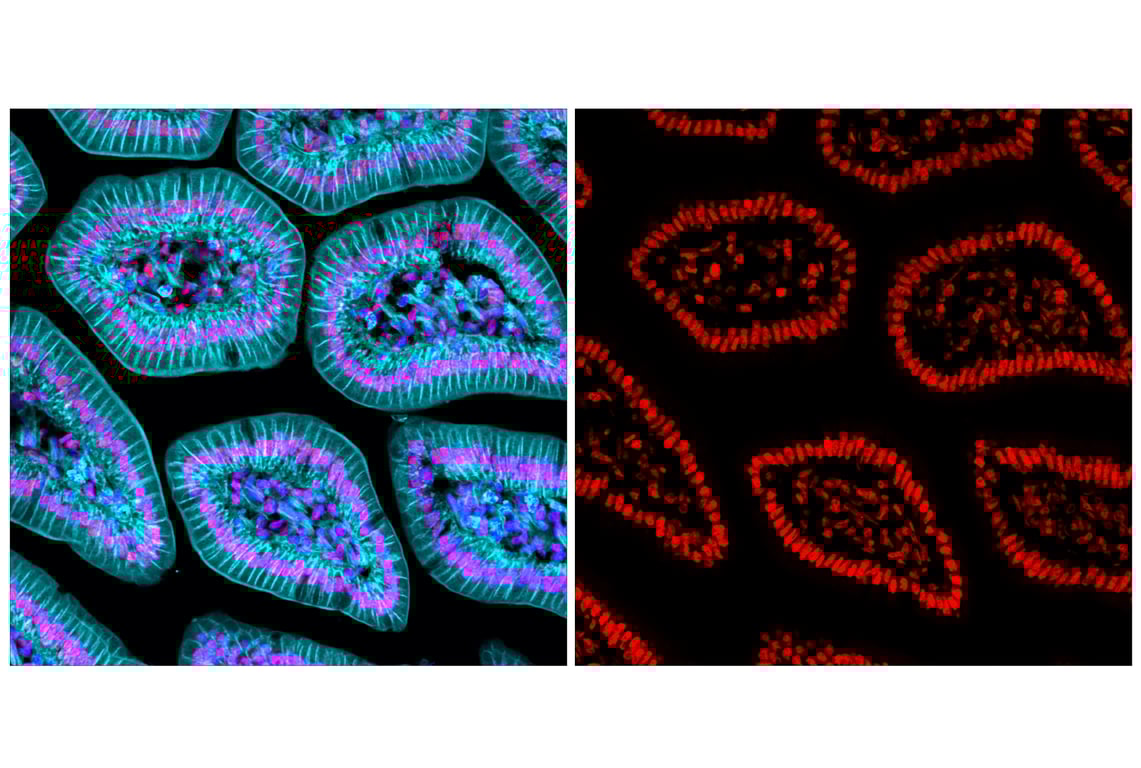Immunofluorescence Image 2: TDP43 (D9R3L) Rabbit Monoclonal Antibody (Alexa Fluor<sup>®</sup> 555 Conjugate)