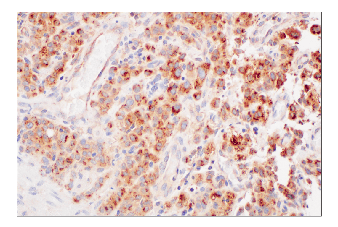 Immunohistochemistry Image 4: LY6E (F8Y1R) Rabbit Monoclonal Antibody