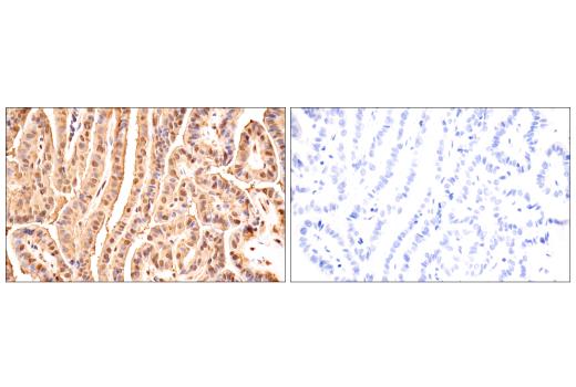 Immunohistochemistry Image 15: Ubiquitin (E6K4Y) Rabbit Monoclonal Antibody (BSA and Azide Free)
