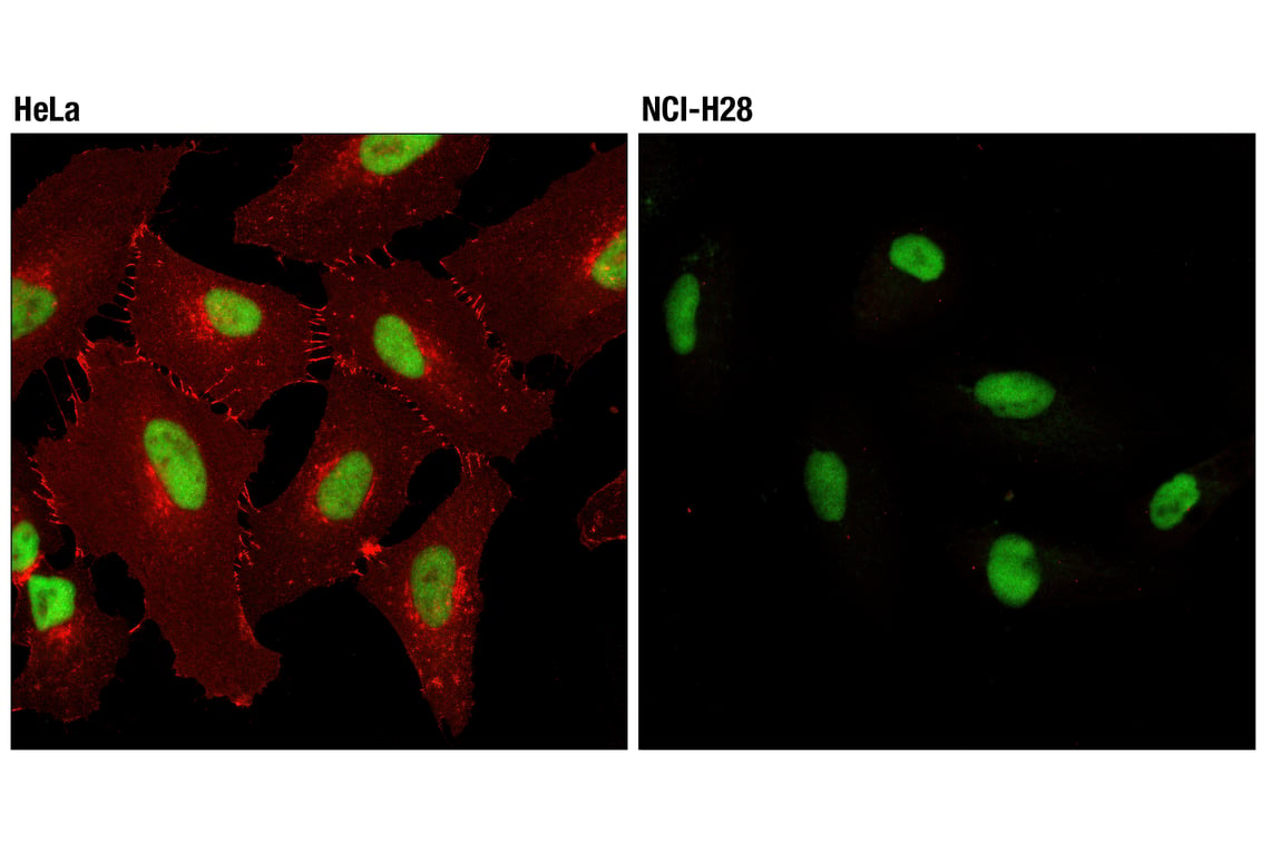 Immunofluorescence Image 1: β-Catenin (L54E2) Mouse mAb (Alexa Fluor<sup>®</sup> 555 Conjugate)