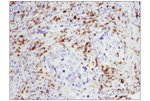 Immunohistochemistry Image 2: CD5 (E8X3S) XP<sup>®</sup> Rabbit mAb