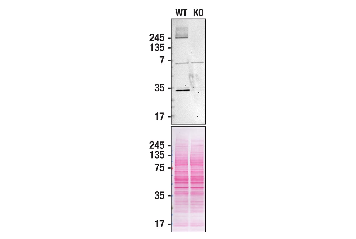 undefined Image 15: Genetics of Parkinson's Disease: Lysosomal Dysfunction Antibody Sampler Kit