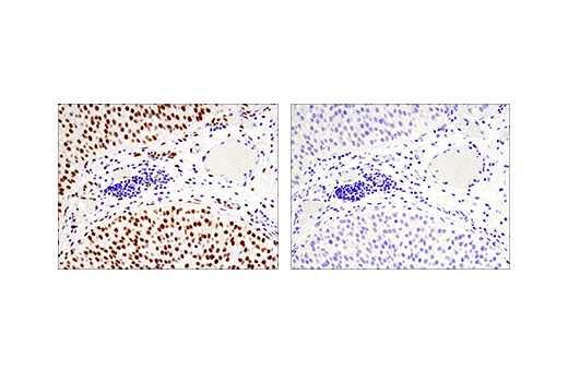 Immunohistochemistry Image 2: Phospho-ATF-2 (Thr71)/ATF-7 (Thr53) (E4A5G) Rabbit Monoclonal Antibody