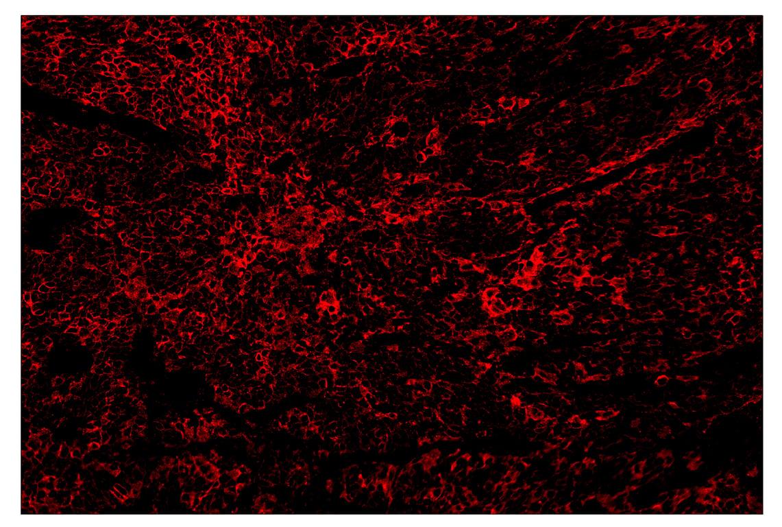 Immunohistochemistry Image 4: PD-L1 (E1L3N<sup>®</sup>) & CO-0005-647 SignalStar<sup>™</sup> Oligo-Antibody Pair