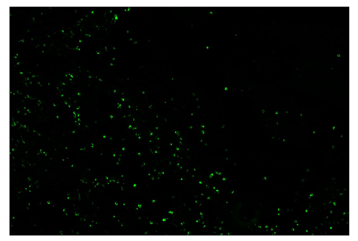 Immunohistochemistry Image 2: Granzyme B (D6E9W) & CO-0009-647 SignalStar<sup>™</sup> Oligo-Antibody Pair