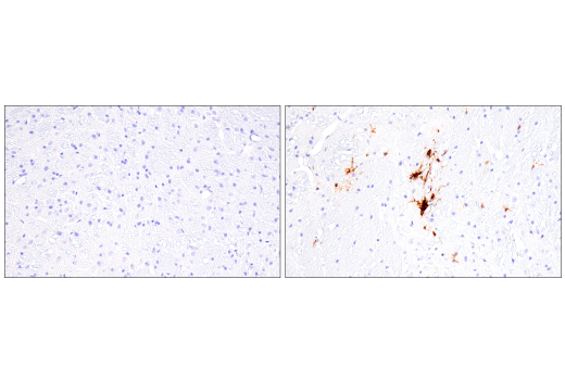 undefined Image 24: Xenophagy Antibody Sampler Kit