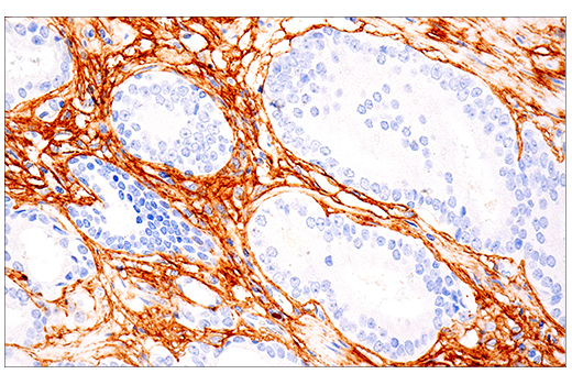 Immunohistochemistry Image 2: COL1A1 (E3E1X) Mouse Monoclonal Antibody (BSA and Azide Free)