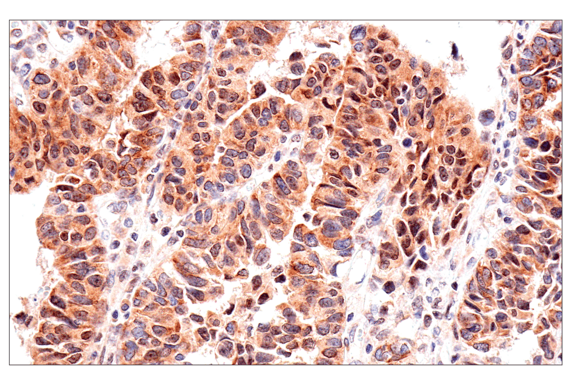 Immunohistochemistry Image 4: ADAR1 p150 Isoform (E6U1U) Rabbit Monoclonal Antibody