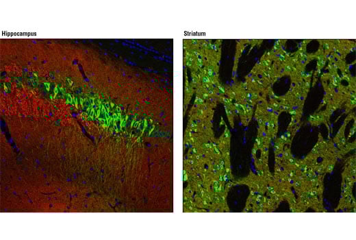 Immunofluorescence Image 1: Non-phospho-STEP (Ser221) (D74H3) Rabbit Monoclonal Antibody