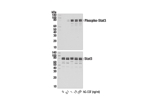 undefined Image 3: Human Granulocyte Colony Stimulating Factor (hG-CSF)