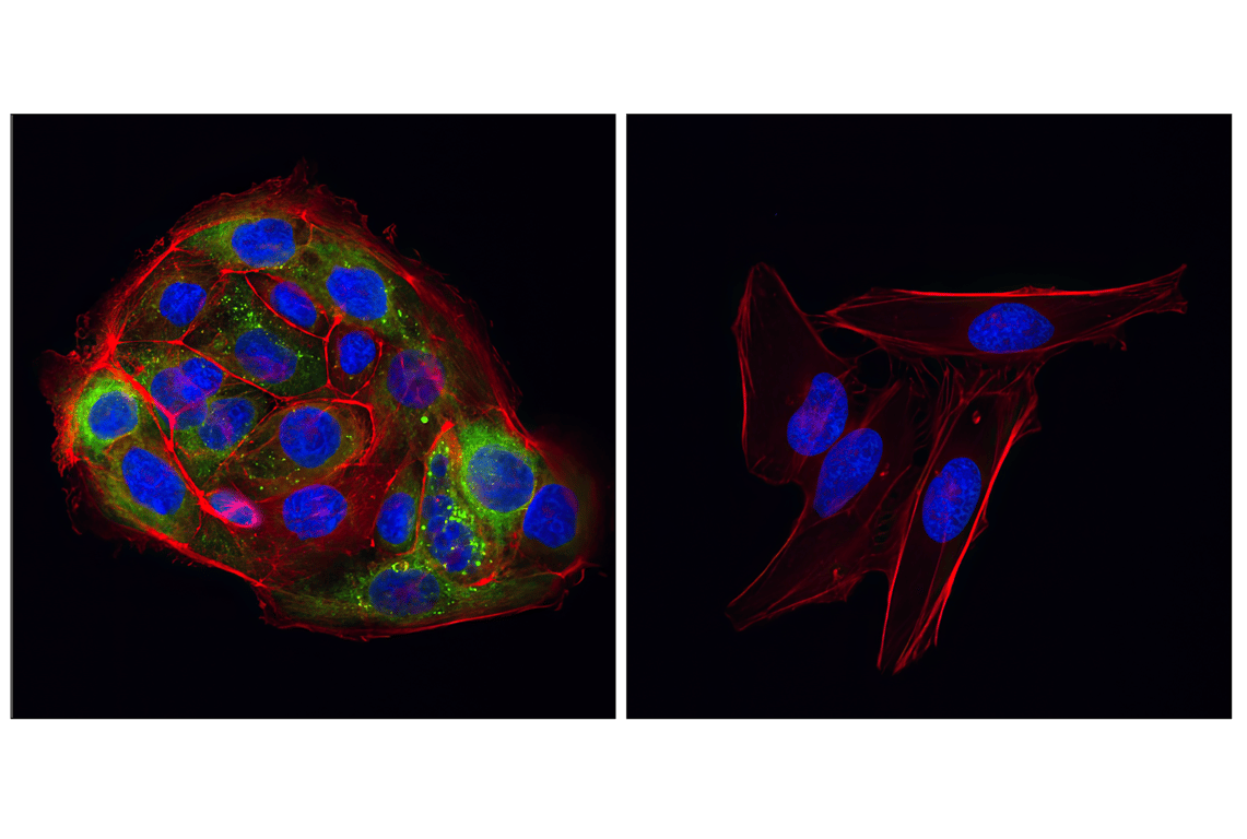 Immunofluorescence Image 1: ROS1 (D4D6) Rabbit Monoclonal Antibody