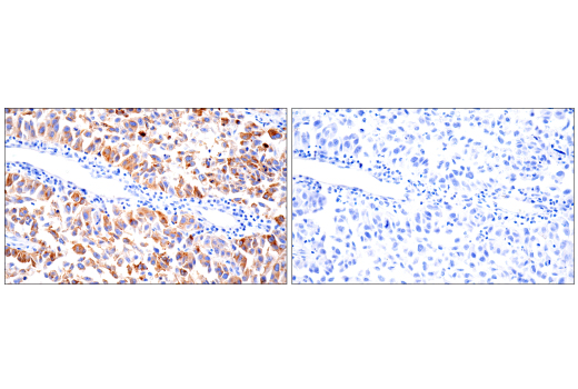 Immunohistochemistry Image 3: PMEL/Melanoma gp100 (HMB45) Mouse Monoclonal Antibody
