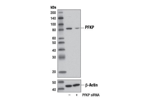 Western Blotting Image 2: PFKP (D2E5) Rabbit Monoclonal Antibody