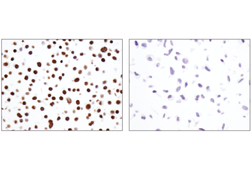 Immunohistochemistry Image 3: Brg1 (E8V5B) Mouse Monoclonal Antibody (BSA and Azide Free)