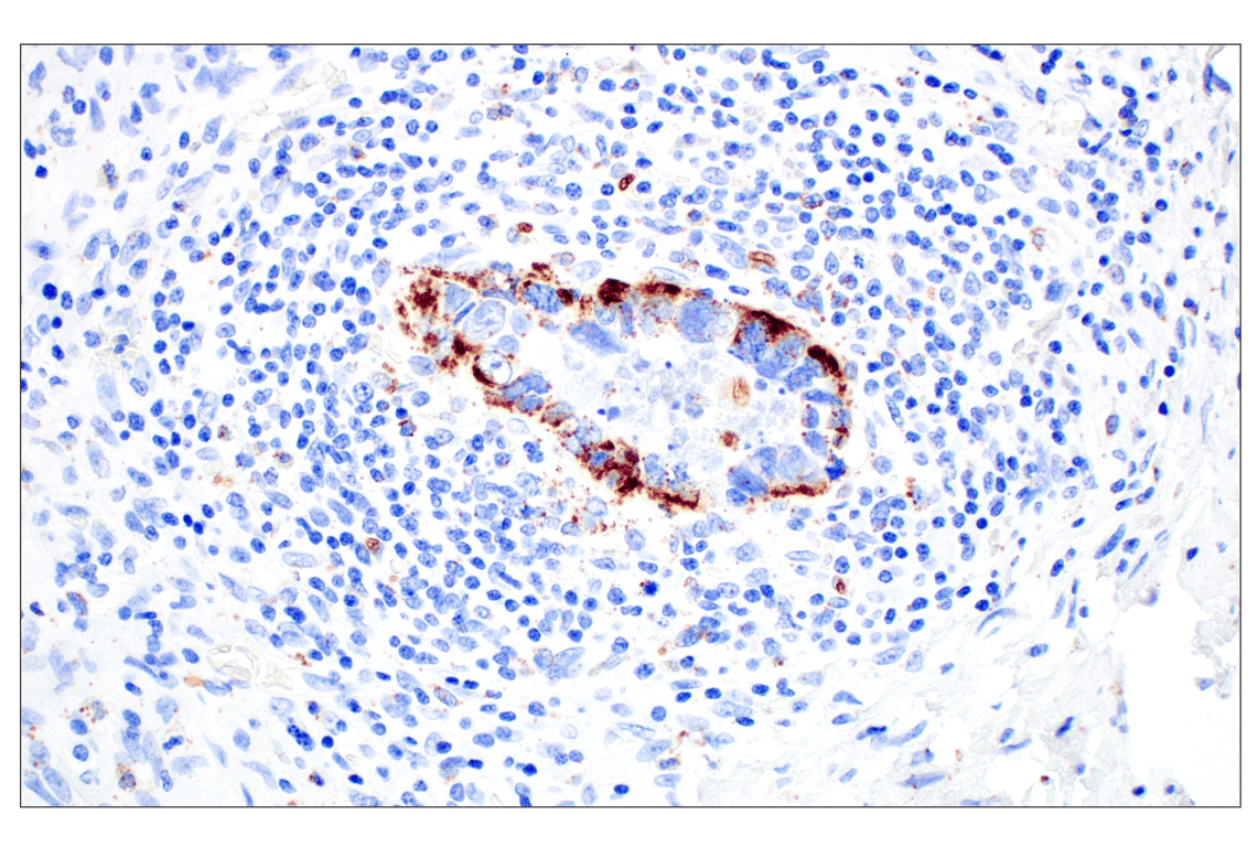 Immunohistochemistry Image 9: Perilipin-2 (E6G6M) Rabbit Monoclonal Antibody