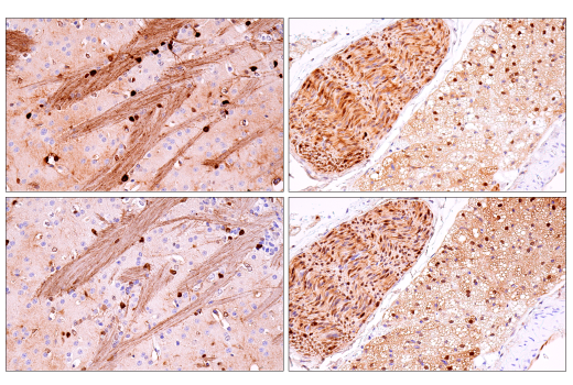 Immunohistochemistry Image 4: S100B (E9F2I) Rabbit Monoclonal Antibody (BSA and Azide Free)