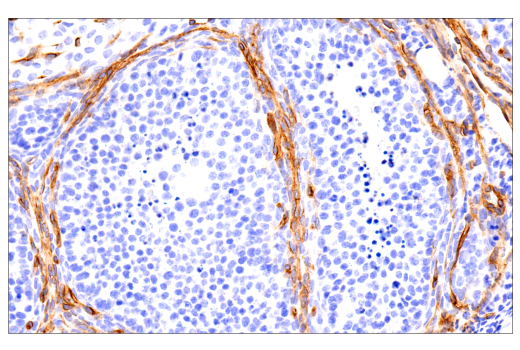 undefined Image 76: Pericyte Antibody Sampler Kit