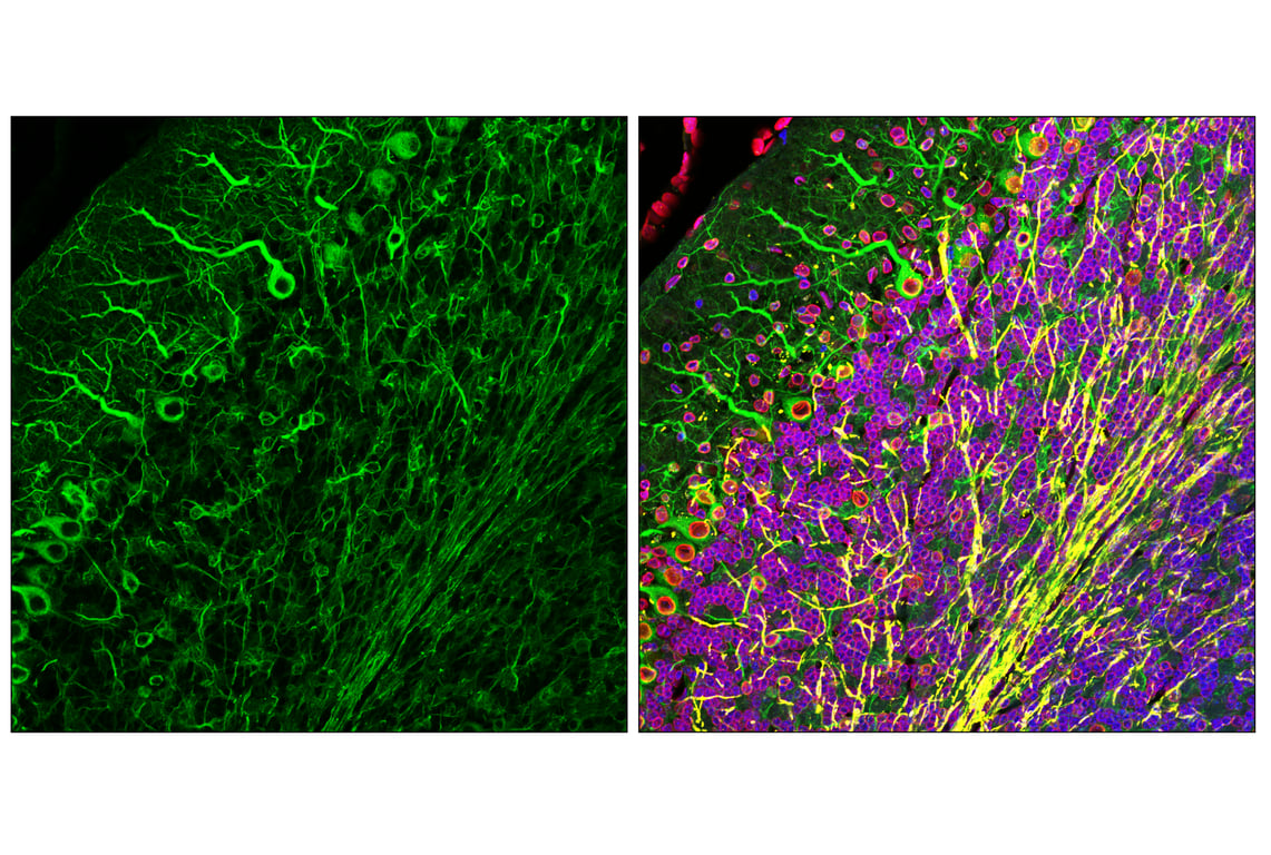 Immunofluorescence Image 2: beta3-Tubulin (E9F3E) Mouse Monoclonal Antibody