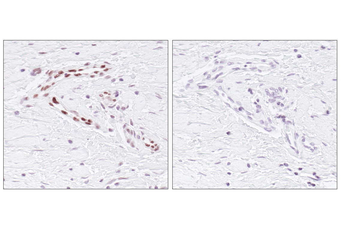 Immunohistochemistry Image 3: Phospho-Stat3 (Tyr705) (D3A7) Rabbit Monoclonal Antibody (BSA and Azide Free)