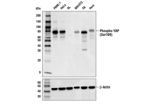 undefined Image 6: PhosphoPlus<sup>®</sup> YAP (Ser109) Antibody Duet