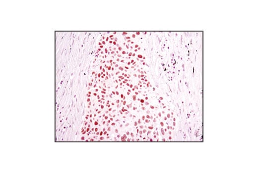 Immunohistochemistry Image 2: Chk2 (1C12) Mouse Monoclonal Antibody (BSA and Azide Free)