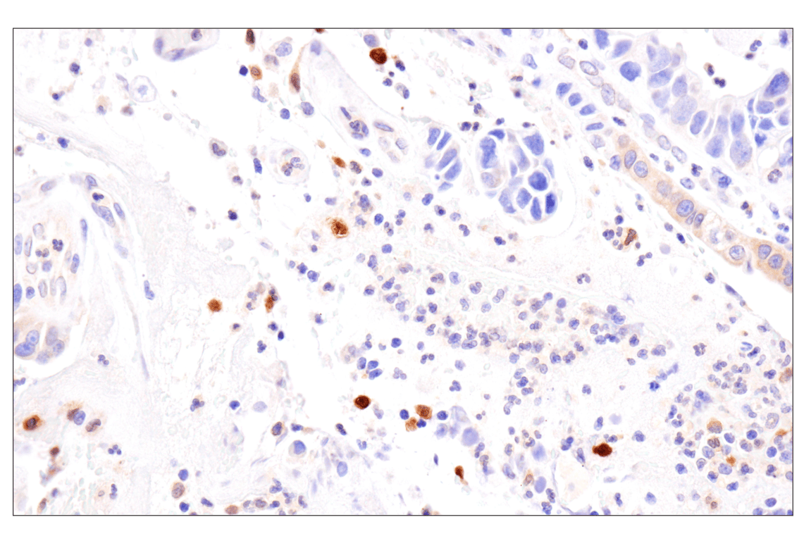 Immunohistochemistry Image 4: APOBEC3A (UMN-13) Rabbit Monoclonal Antibody (BSA and Azide Free)