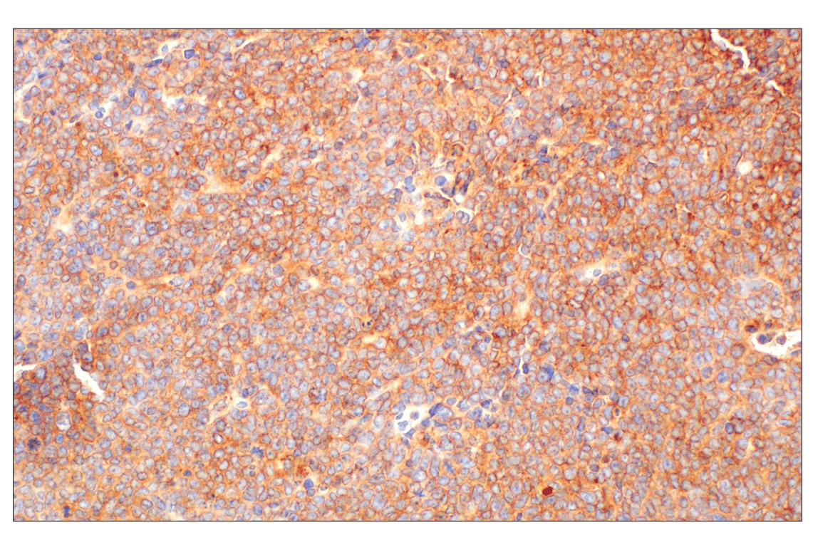 Immunohistochemistry Image 5: RhoA (67B9) Rabbit Monoclonal Antibody
