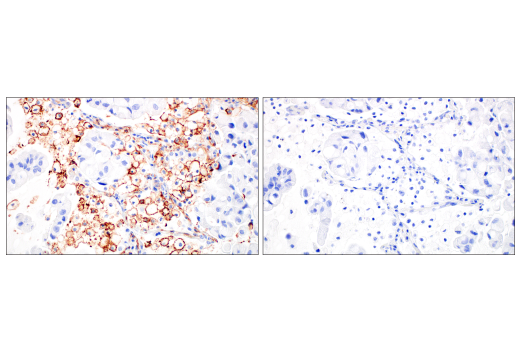 Immunohistochemistry Image 8: Fc-gammaRIIB (E4D2F) Rabbit Monoclonal Antibody (BSA and Azide Free)