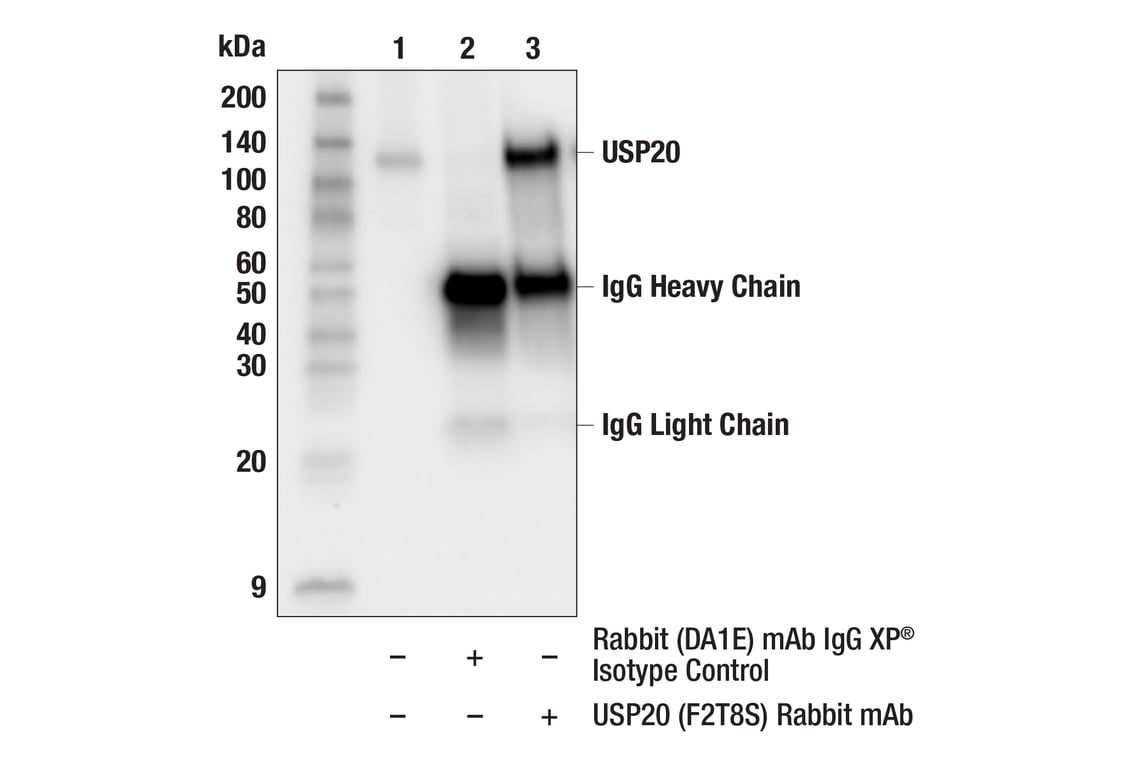 Immunoprecipitation Image 1: USP20 (F2T8S) Rabbit Monoclonal Antibody