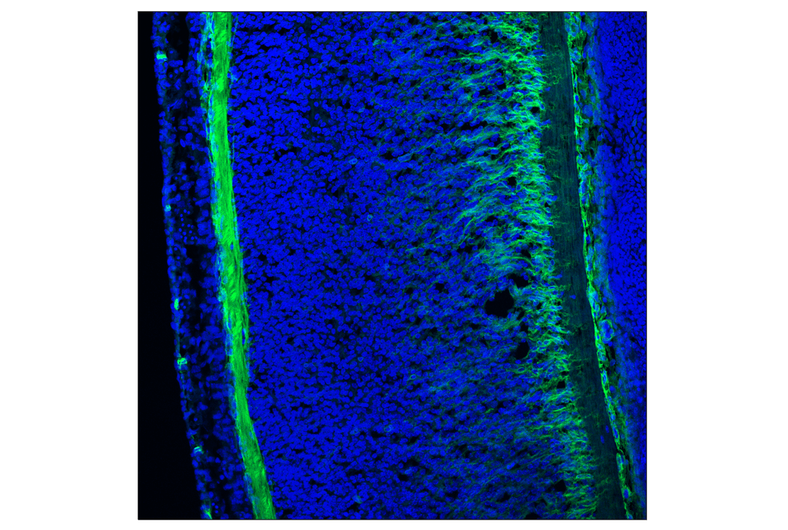 Immunofluorescence Image 3: p75NTR (F2L9S) Rabbit Monoclonal Antibody
