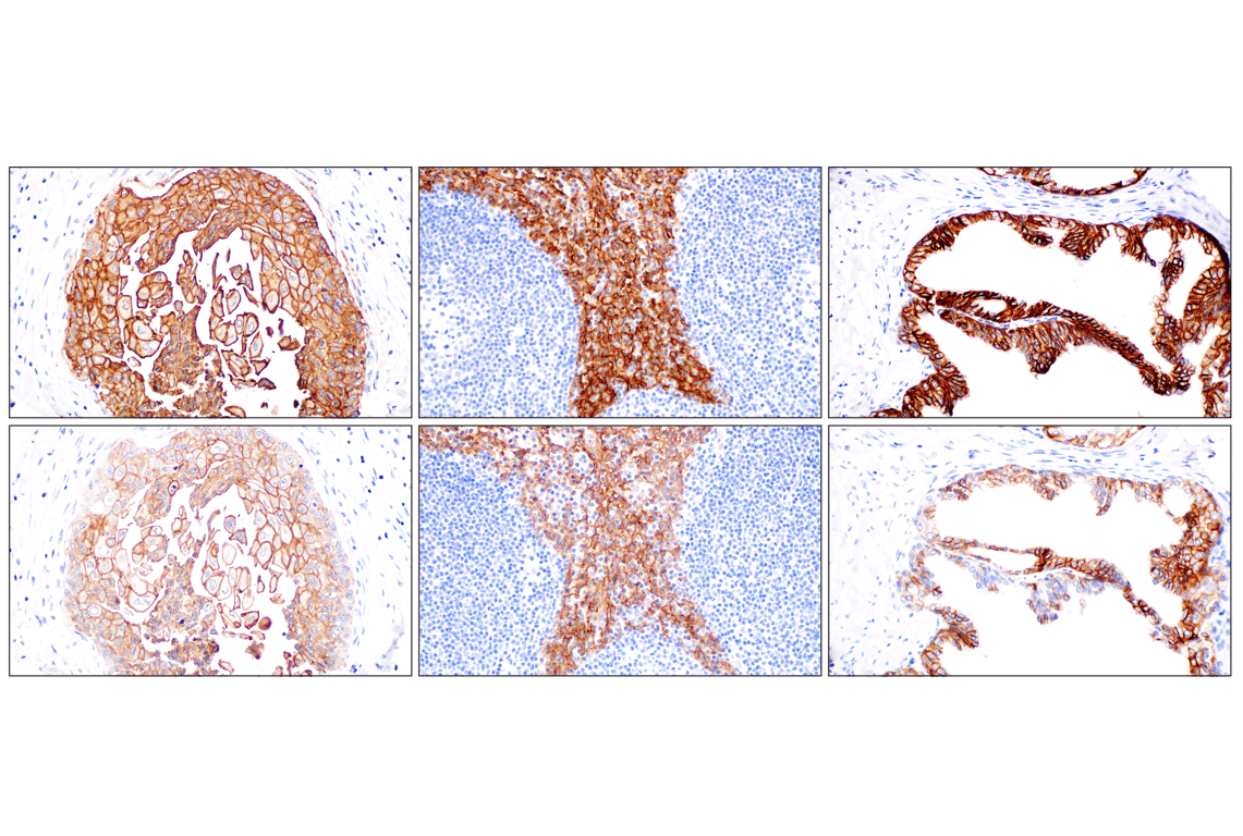 Immunohistochemistry Image 10: TACSTD2/TROP2 (F4W4J) Rabbit Monoclonal Antibody